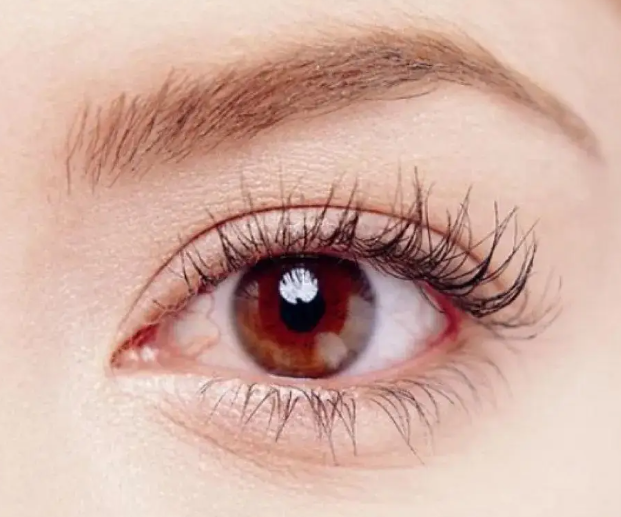 春季眼过敏频发,宝璋医院为您支招!